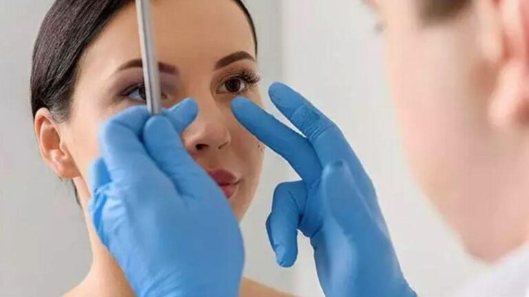 Rinoplasti sonrası en az 2 ay gözlük kullanılmamalı