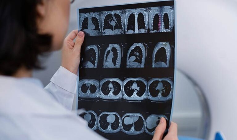 Bilim insanlarından çığır açacak keşif: Alzheimer riskini düşürecek gen bulundu! – Son Dakika Bilim Teknoloji,Yaşam,Dünya Haberleri