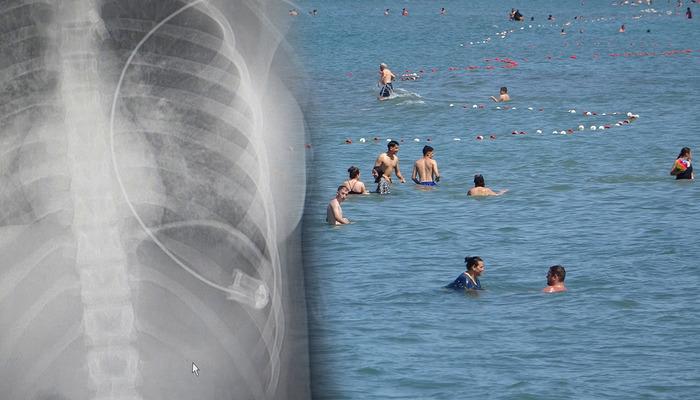 Tatil mevsimi başladı! Boğulma tehlikesi kapıda: “Son 4 yılda 4 bine yakın vatandaşımızı kaybettik”