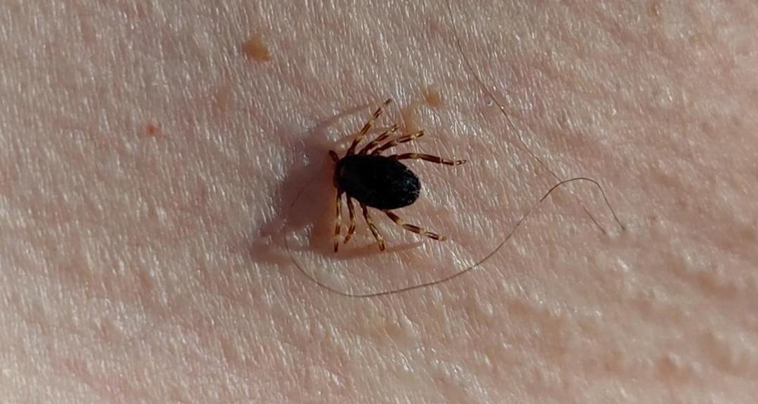 Dikkat! Nane Bildirimi: