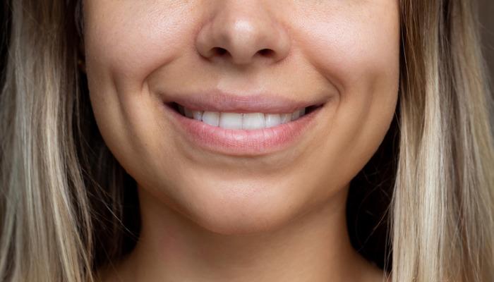 Yeni estetik çılgınlığı: Gamzeplasti ameliyatı sosyal medyada yayılıyor!